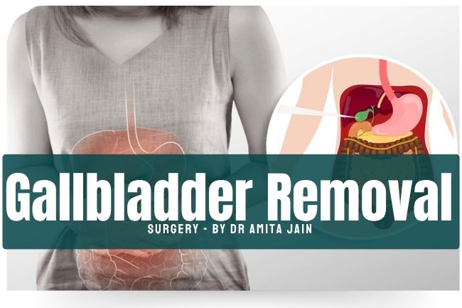 best gallstone removal doctor surgeon Dr Amita Jain